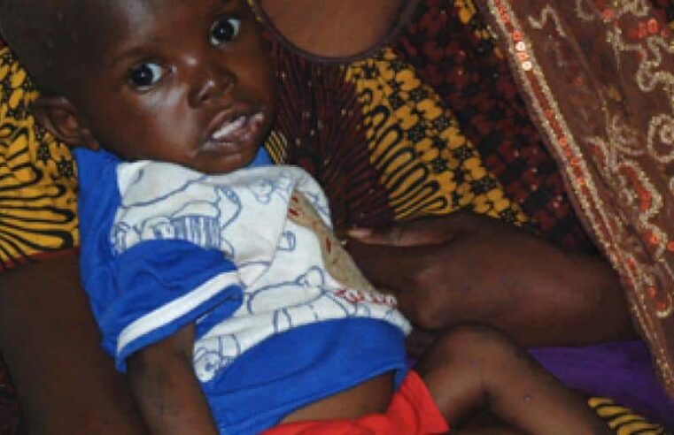 Malnutrition in Mali: health crisis and prevention strategies