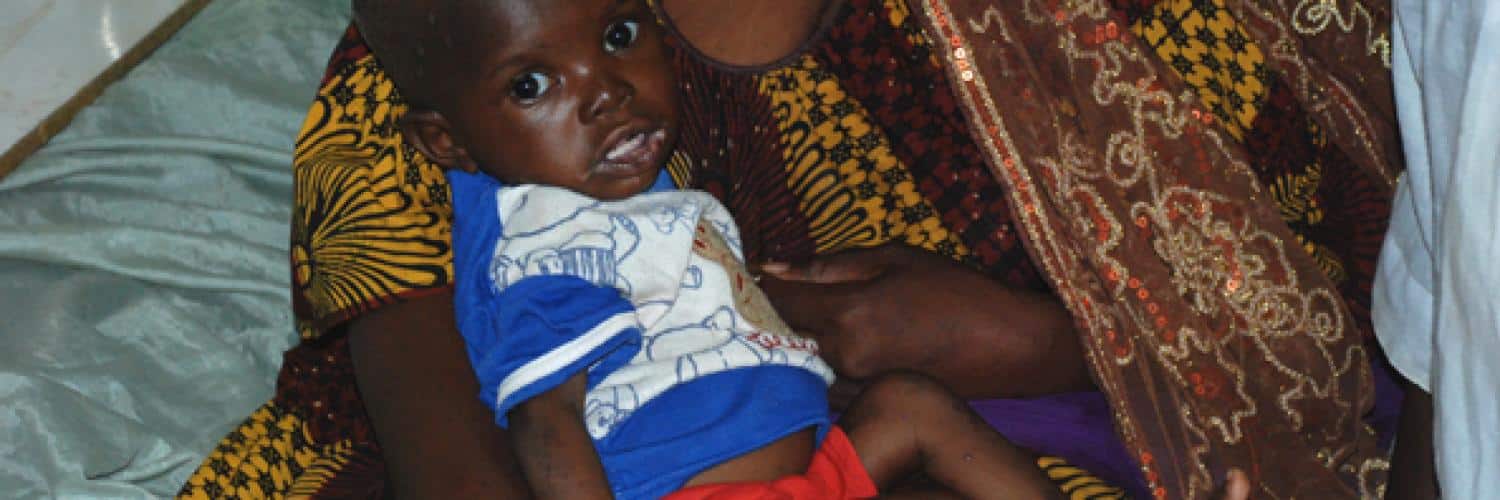 Malnutrition in Mali: health crisis and prevention strategies
