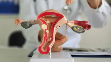 La ligature ou l'ablation des trompes permet une contraception définitive chez les femmes qui ne veulent pas d'enfant