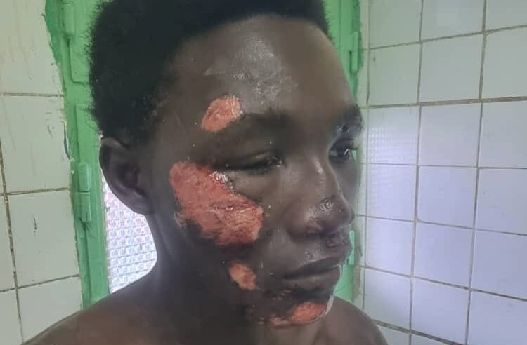 N’Djaména: father demands enhanced security after son’s assault near camp 27