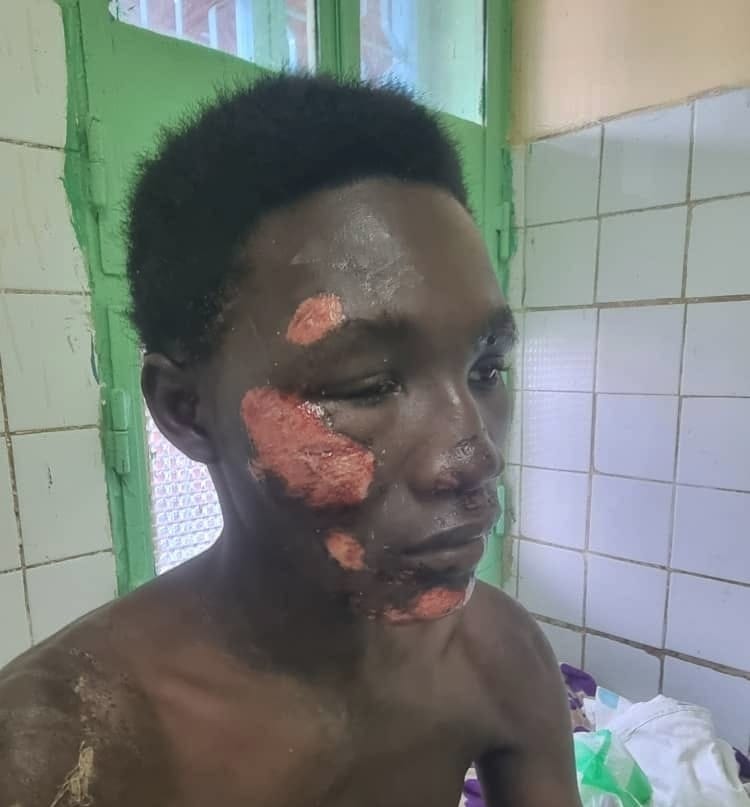 N’Djaména: father demands enhanced security after son’s assault near camp 27