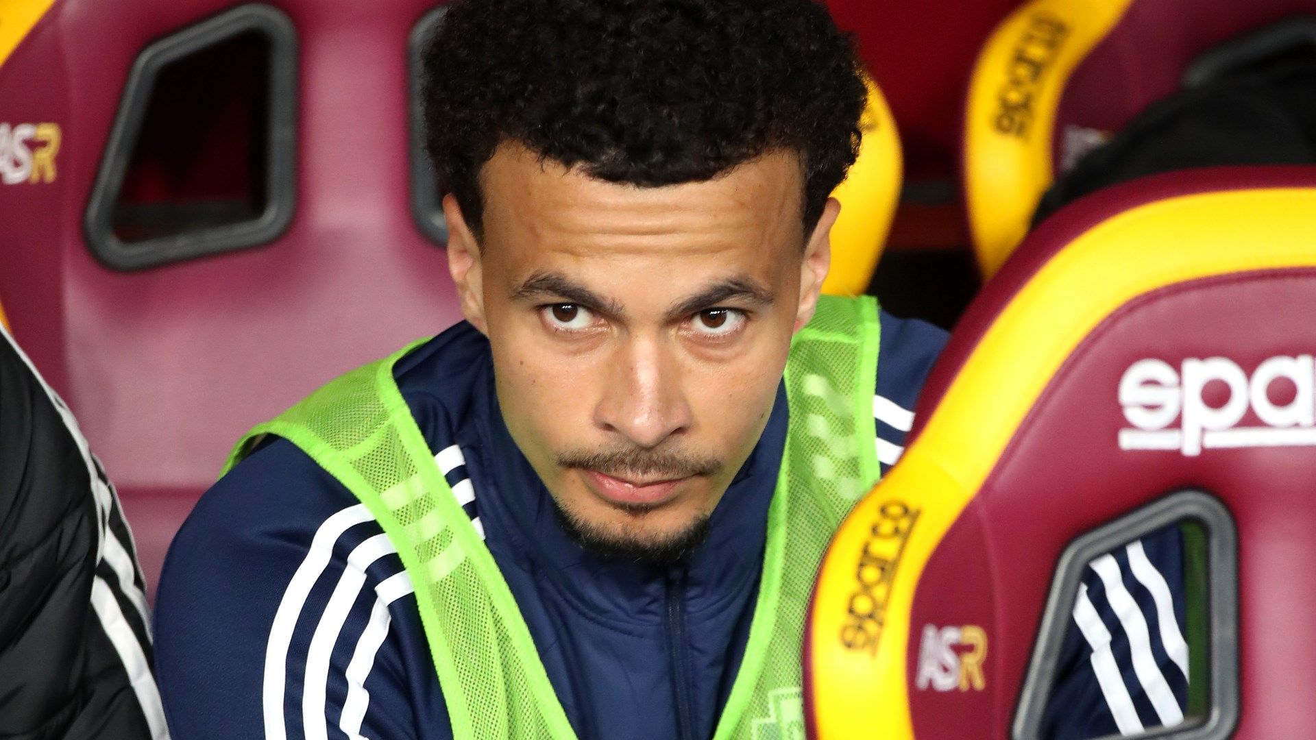Dele alli’s Serie A struggle: why the former Tottenham star failed at Como while McTominay thrives in Naples